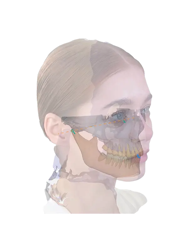 4D digital dental planning scan