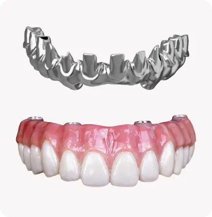 Zirconia detail diagram